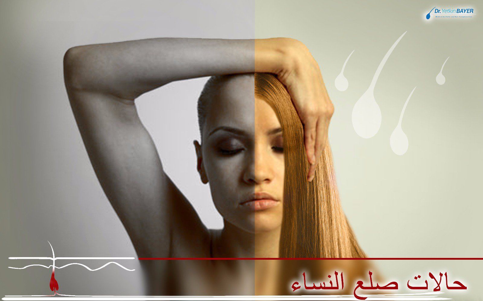 اسباب تساقط الشعر عند النساء وعلاجه 1