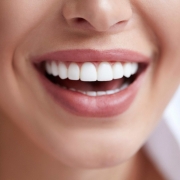 تبيض الاسنان في تركيا 2020 _ طرق تبييض الاسنان الأحدث و تكلفة تببيض الاسنان في تركيا.