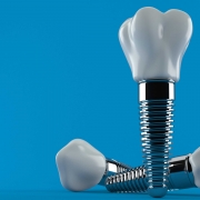 زراعة الاسنان في تركيا 2020 _ طرق زراعة الاسنان و تكلفة زراعة الاسنان في تركيا .