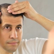 ما هو تساقط الشعر الكربي ؟