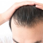أهم أسباب تساقط الشعر