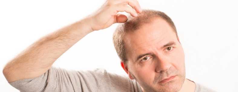 هل يمكن إجراء زراعة الشعر على الشعر الخفيف؟