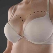 Breast Augmentation Turkey | Breast Enlargement Surgery 18