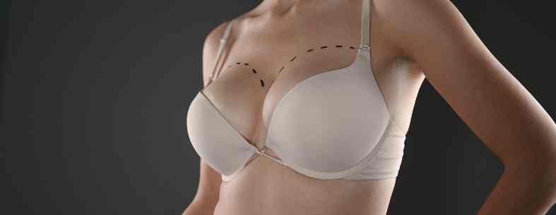 Breast Augmentation Turkey | Breast Enlargement Surgery 1