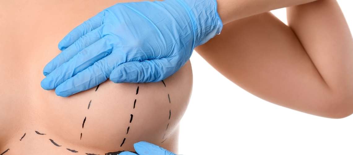 Breast Lift Surgery Cost § Reviews in Turkey