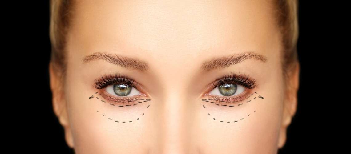 Canthoplasty Surgery Cost § Reviews in Turkey