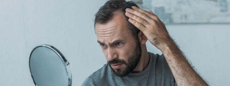 Hair Transplant or Forehead Reduction
