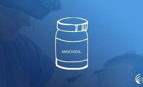 Can Minoxidil be used After Hair Transplantation?