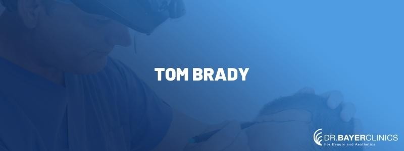 Tom Brady Hair Transplant 