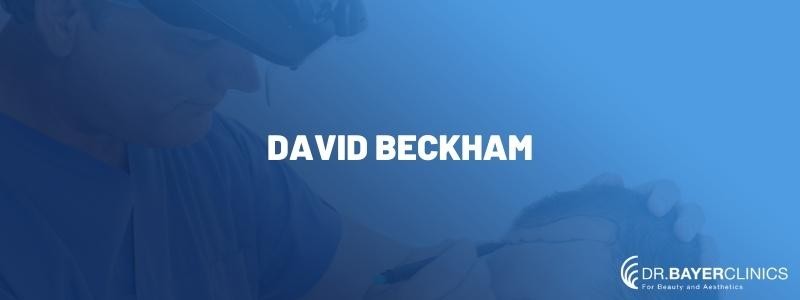 David Beckham Hair Transplantation