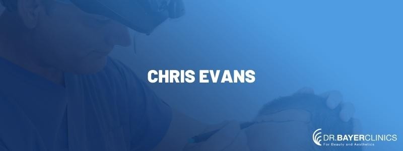 Chris Evans Hair Transplant | Dr. Yetkin Bayer Clinics