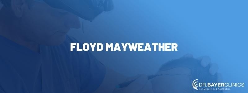  Floyd Mayweather Hair Transplantation 