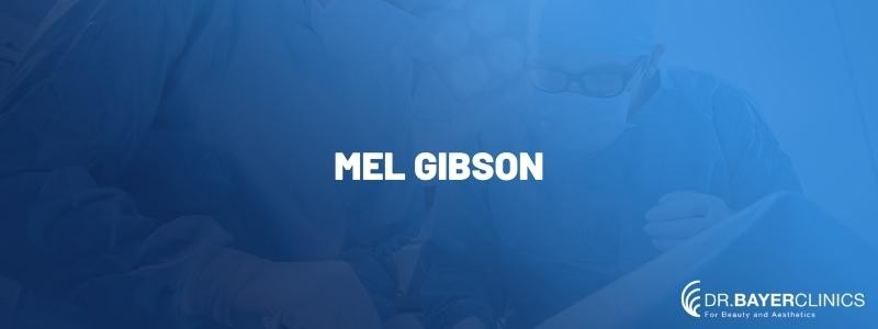 Mel Gibson’s Hair Transplantation