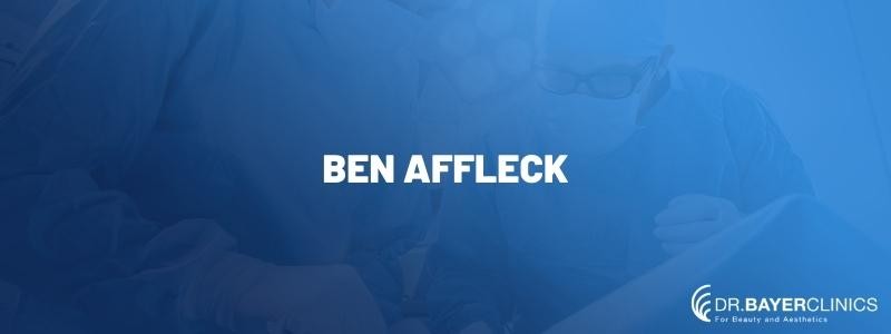 Ben Affleck’s Hair Transplantation