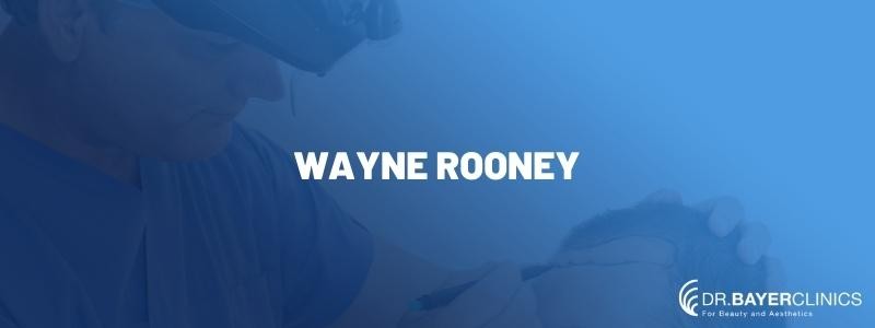 Wayne Rooney’s Hair Transplant 