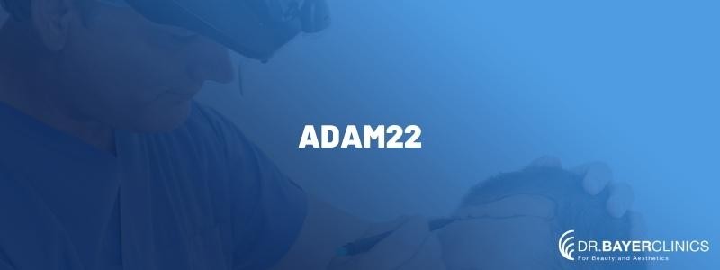 Adam22 The no jumper Podcast had a Hair Transplant 