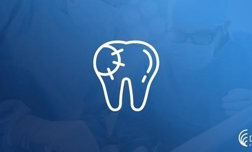 Diş Dolgusu Nedir? 72