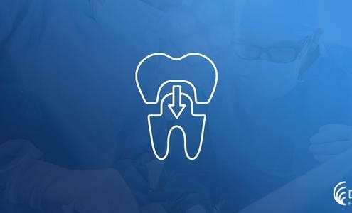Hassas Bağlantılı Diş Protezleri Nedir? 12
