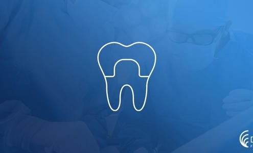 Kancalı Diş Protezleri Nasıl Takılır? 11