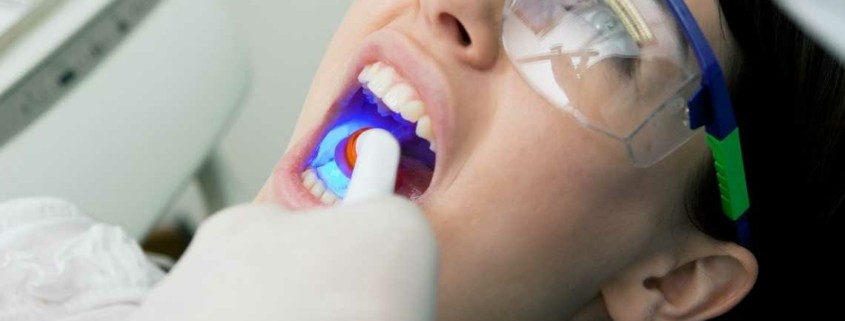 علاج الكل في 4 زراعة الأسنان في تركيا