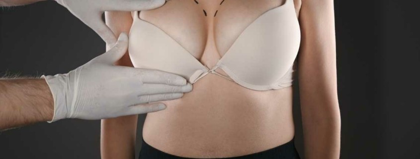 Redução de mama – Riscos e efeitos colaterais