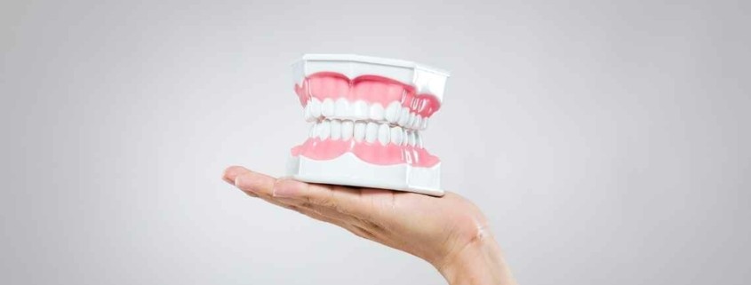 ما هي بدائل زراعة الأسنان؟