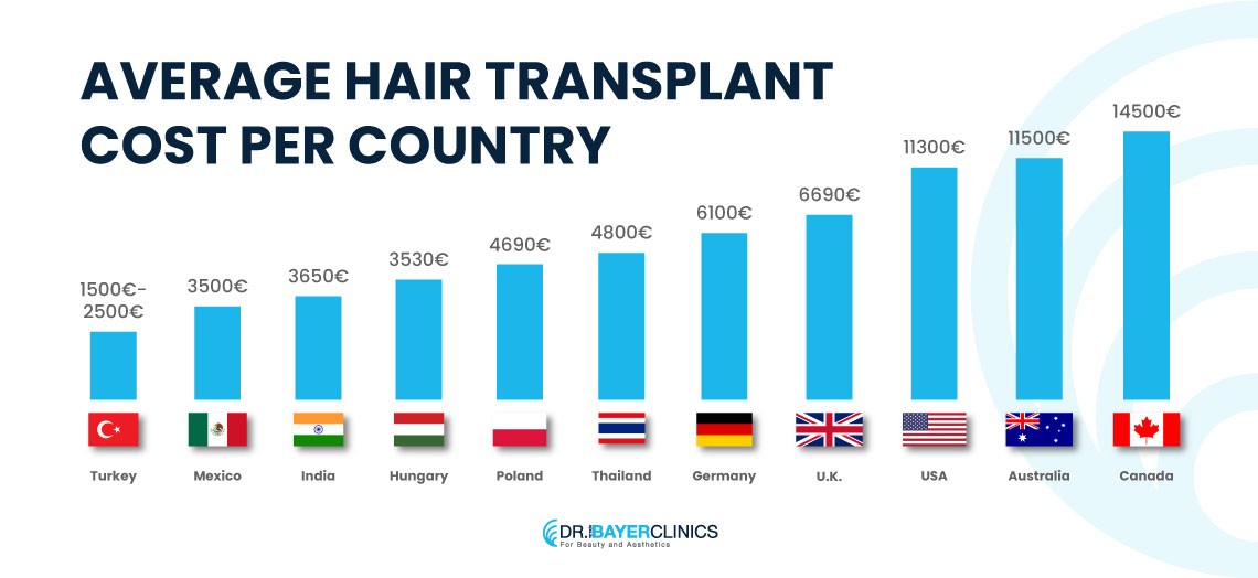 Average Hair Transplant Cost Per Country
