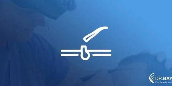 SAC-EKIMI-SONRASI-SAC-KUSMESI