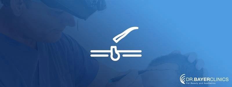 SAC-EKIMI-SONRASI-SAC-KUSMESI