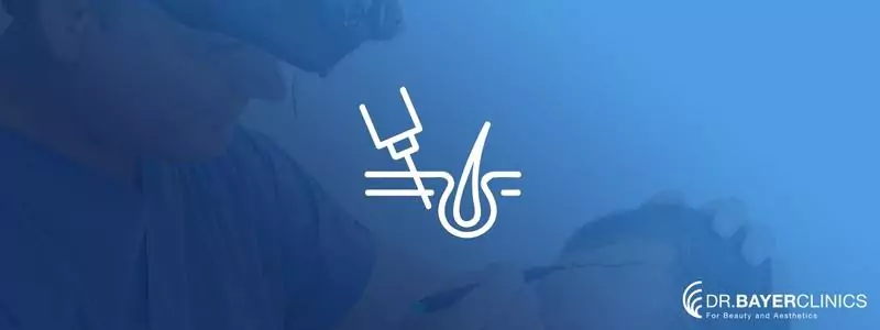 sac-ekimi-sonrasi-ay-ay-gelisim-673c472e2e820