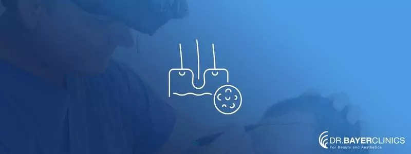 sac-ekimi-sonrasi-egzama-673b4d0e4d77f