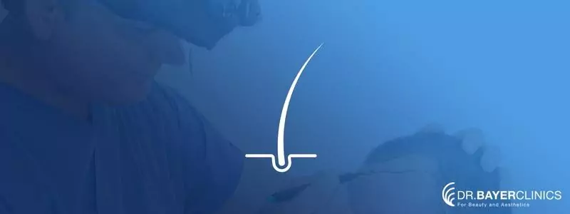 sac-ekimi-sonrasi-iltihaplanma-673c3d0f2e98d