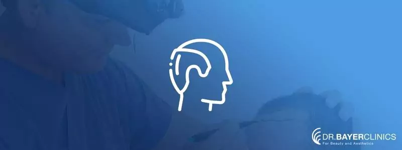 sac-ekimi-sonrasi-protez-sac-673c446422473