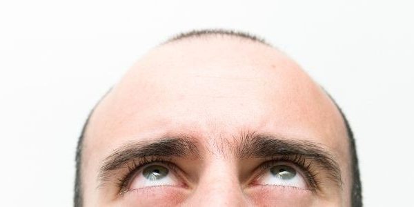 ВЫЗЫВАЕТ-ЛИ-ПЕРЕСАДКА-ВОЛОС-РАК (1)