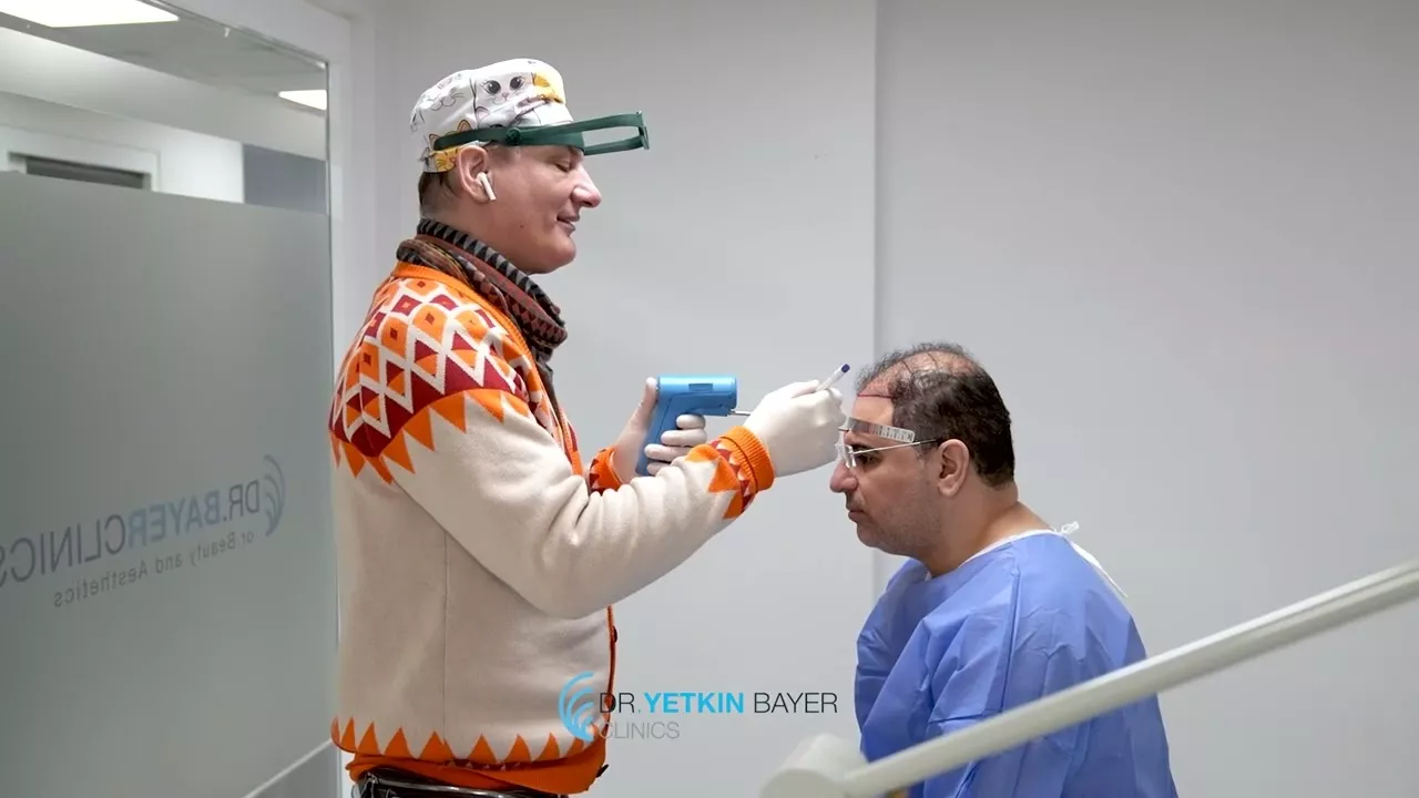 hair-transplant-training-6900b086e1b12