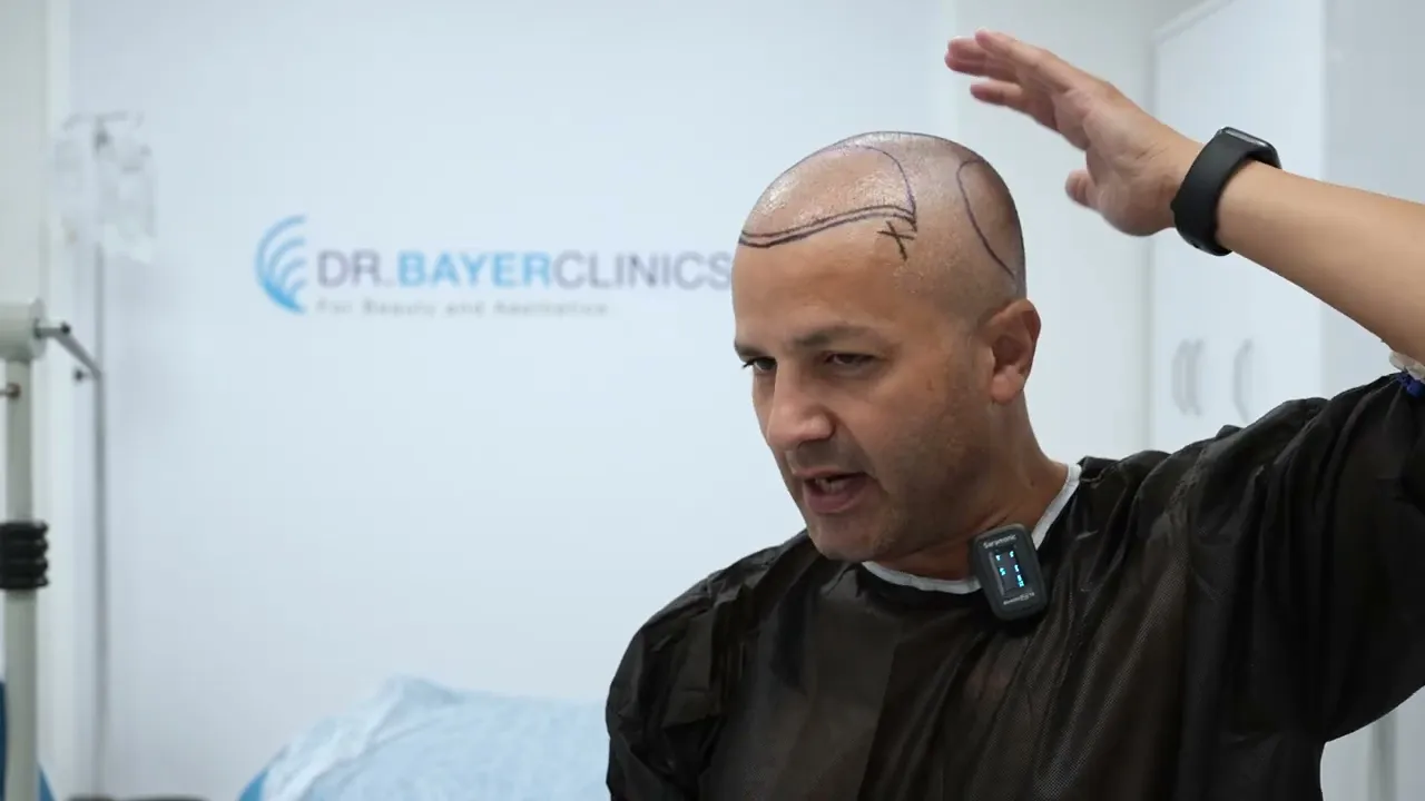 Hair Transplant Training