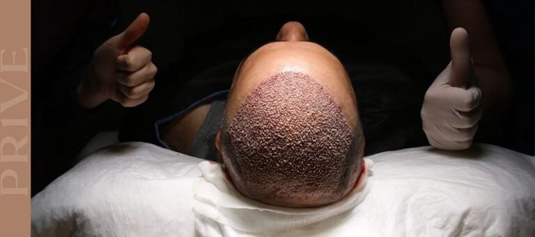Bepanthol Cream Usage After A Hair Transplant