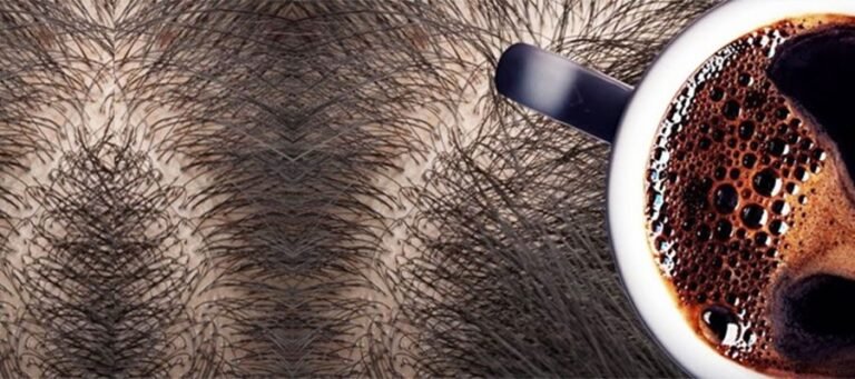 Coffee Before And After Hair Transplant