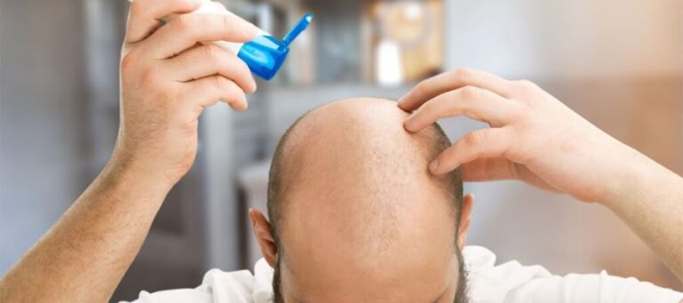 Spraying Saline After Having a Hair Transplant