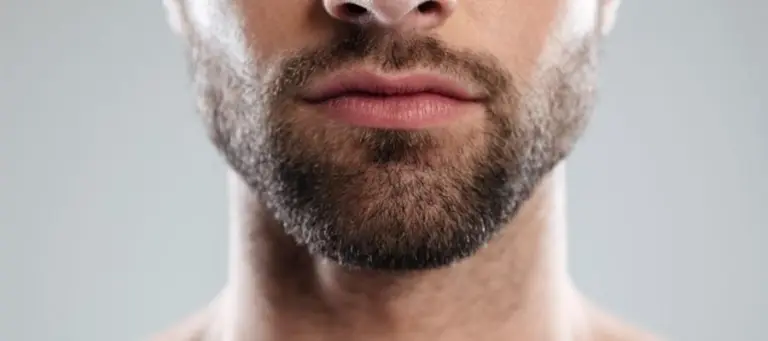 Beard Transplantation in Turkey
