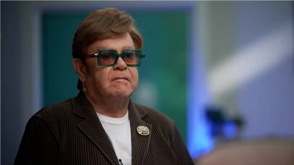 Elton John Hair Translplant