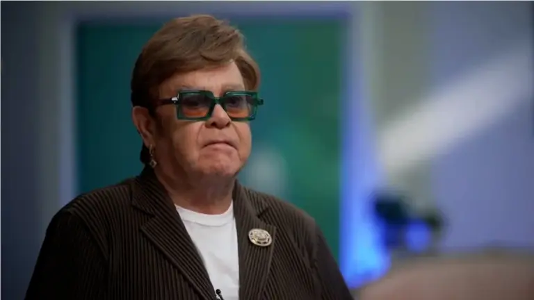 Elton John Hair Translplant
