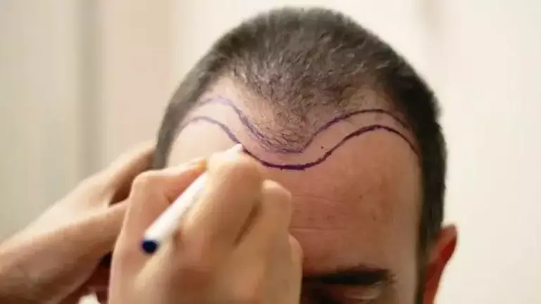 hair tr